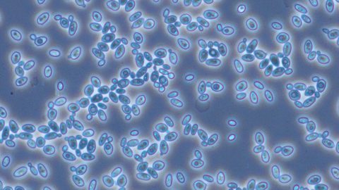 BRAINBiocatalysts_Yeast cells 16-9